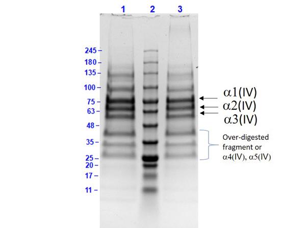 Collagen IV Native Protein - Human Collagen Type IV. <br />Lane 1: Human Collagen Type IV Reduced (5 &mu;g).<br />Lane 2: Prestained Molecular Weight Protein.<br />Lane 3: Human Collagen Type IV Non-Reduced (5 &mu;g). <br />4-20% Gel, Coomassie Stained. Observed MW: Type IV a1, a2, a3 bands.